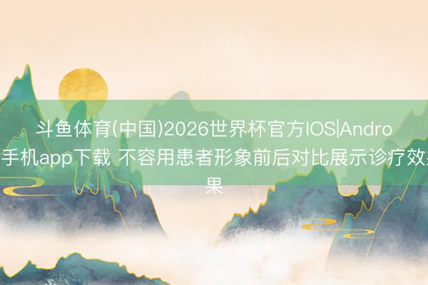 斗鱼体育(中国)2026世界杯官方IOS|Android手机app下载 不容用患者形象前后对比展示诊疗效果